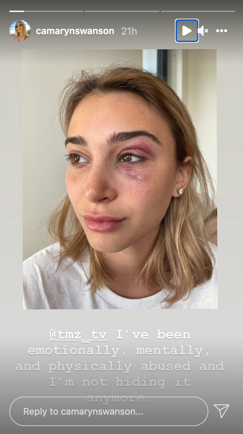 TYGA for the Allegedly Assaulting his GF