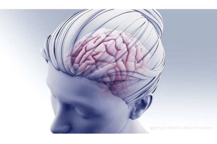american-heart-association-brain-health-5215