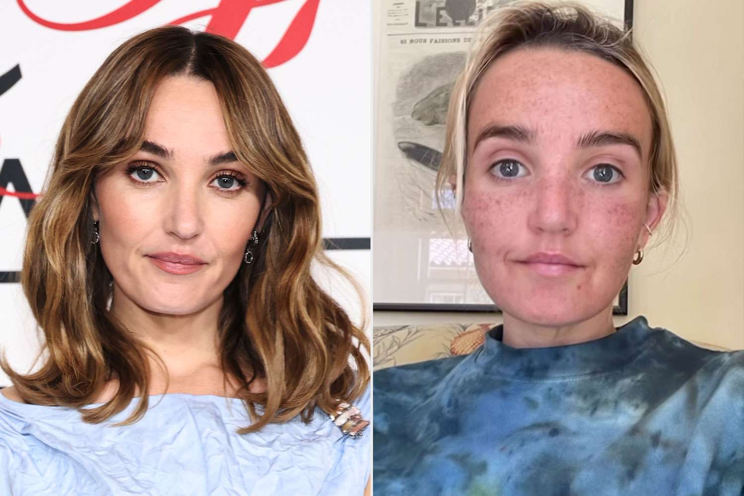 Breaking: Chloe Fineman Shares Shocking Photos of Her 'Botched' Med Spa Experience